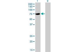 Western Blot analysis of CBFA2T2 expression in transfected 293T cell line by CBFA2T2 monoclonal antibody (M15), clone 2C10. (CBFA2T2 抗体  (AA 201-304))
