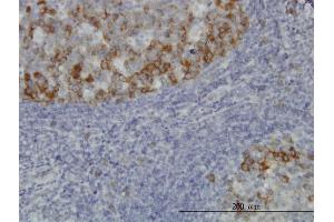 Immunoperoxidase of monoclonal antibody to BUB1B on formalin-fixed paraffin-embedded human tonsil. (BUB1B 抗体  (AA 1-130))