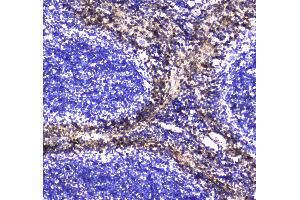IHC analysis of S100A10 using anti-S100A10 antibody . (S100A10 抗体  (AA 4-94))