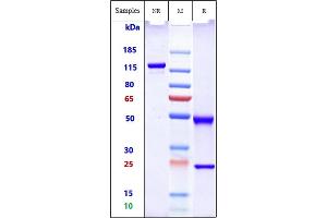 Anti-ALP Reference Antibody (Seagen Patent Anti-Alpp) on SDS-PAGE under reducing (R) condition.
