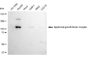 Western blotting analysis using Epidermal growth factor receptor antibody (ABIN7798471).
