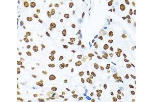 Immunohistochemistry (Paraffin-embedded Sections) (IHC (p)) image for anti-KH Domain Containing, RNA Binding, Signal Transduction Associated 1 (KHDRBS1) antibody (ABIN7261952)