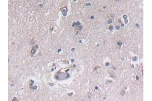 Detection of PON3 in Human Cerebrum Tissue using Polyclonal Antibody to Paraoxonase 3 (PON3) (PON3 抗体  (AA 2-354))