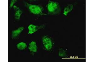 Image no. 3 for anti-Homeobox D11 (HOXD11) (AA 1-77) antibody (ABIN599383) (HOXD11 抗体  (AA 1-77))