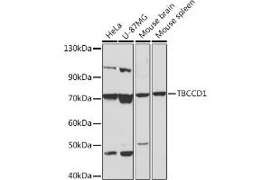 Western blot analysis of extracts of various cell lines, using TBCCD1 Rabbit pAb (ABIN7270751) at 1:1000 dilution. (TBCCD1 抗体)