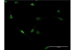 Immunofluorescence of monoclonal antibody to ZNF76 on HeLa cell. (ZNF76 抗体  (AA 471-570))