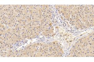 Detection of ADRP in Human Liver Tissue using Polyclonal Antibody to Adipose Differentiation Related Protein (ADRP) (ADRP 抗体  (AA 5-232))