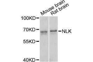 Western blot analysis of extracts of various cell lines, using NLK antibody (ABIN5971636) at 1/1000 dilution. (Nemo-Like Kinase 抗体)