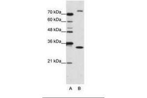 Image no. 1 for anti-Exosome Component 2 (EXOSC2) (N-Term) antibody (ABIN202179) (EXOSC2 抗体  (N-Term))