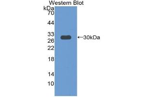 Western blot analysis of the recombinant protein. (Paxillin 抗体  (AA 347-578))