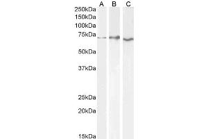 Western Blotting (WB) image for anti-Acetylcholinesterase (AChE) (C-Term) antibody (ABIN185357)