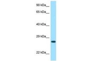 Image no. 1 for anti-Lysozyme G-Like 2 (LYG2) (AA 35-84) antibody (ABIN6748055) (LYG2 抗体  (AA 35-84))