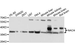 Western blot analysis of extracts of various cells, using NACA antibody. (NACA 抗体)
