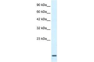 WB Suggested Anti-HOXA1 Antibody Titration:  2. (HOXA1 抗体  (Middle Region))