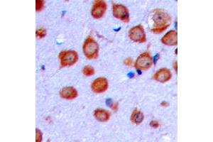 Immunohistochemical analysis of OLFML2A staining in human brain formalin fixed paraffin embedded tissue section. (OLFML2A 抗体  (Center))