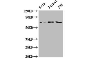 Western Blot Positive WB detected in: Hela whole cell lysate, Jurkat whole cell lysate, 293 whole cell lysate All lanes: INTS9 antibody at 1:2000 Secondary Goat polyclonal to rabbit IgG at 1/50000 dilution Predicted band size: 74, 72 kDa Observed band size: 74 kDa (INTS9 抗体  (AA 368-658))