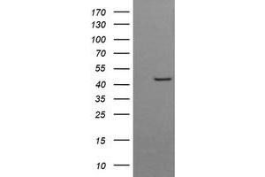 Image no. 2 for anti-butyrobetaine (Gamma), 2-Oxoglutarate Dioxygenase (Gamma-butyrobetaine Hydroxylase) 1 (BBOX1) antibody (ABIN1496815)