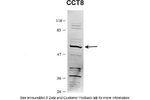 Sample Type: HEK 293 (10ug)Primary Dilution: 1:1000Secondary Antibody: conjugated goat anti-rabbitSecondary Dilution: 1:10,000Image Submitted By: Amy GrayBrigham Young University (CCT8 抗体  (C-Term))