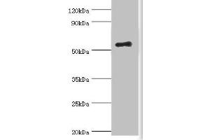 Western blot All lanes: Zinc finger protein Aiolos antibody at 8 μg/mL + HepG2 whole cell lysate Secondary Goat polyclonal to rabbit IgG at 1/10000 dilution Predicted band size: 59, 52, 54, 30, 48, 50, 55, 42, 36, 33, 43, 31 kDa Observed band size: 59 kDa (IKZF3 抗体  (AA 280-450))