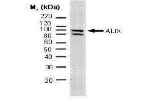 Western Blotting (WB) image for anti-Programmed Cell Death 6 Interacting Protein (PDCD6IP) antibody (ABIN181090)
