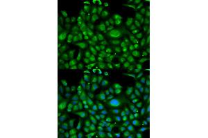 Immunofluorescence analysis of U2OS cells using HSPA1L antibody (ABIN5970952). (HSPA1L 抗体)