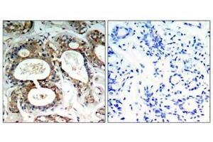 Immunohistochemistry (IHC) image for anti-Protein tyrosine Phosphatase, Non-Receptor Type 11 (PTPN11) (pTyr542) antibody (ABIN7139025)