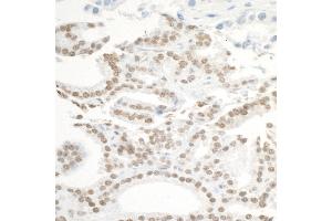 Immunohistochemistry (IHC) image for anti-Bromodomain Containing 3 (BRD3) (AA 676-726) antibody (ABIN7453851)
