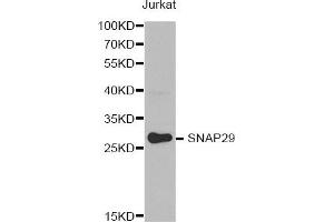 Western Blotting (WB) image for anti-Synaptosomal-Associated Protein, 29kDa (SNAP29) antibody (ABIN1874886) (SNAP29 抗体)
