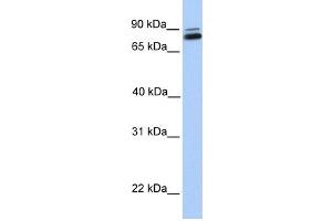 WB Suggested Anti-GGTL3 Antibody Titration:  0. (GGT7 抗体  (C-Term))