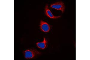 Immunofluorescent analysis of IFITM3 staining in HeLa cells. (IFITM3 抗体  (N-Term))