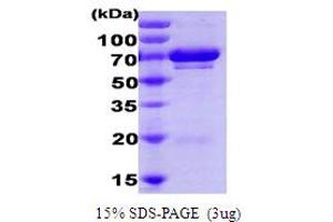 SDS-PAGE (SDS) image for Ubiquitin-Conjugating Enzyme E2G 2 (UBE2G2) protein (ABIN666841) (UBE2G2 蛋白)