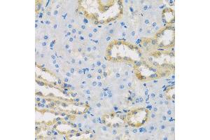 Immunohistochemistry of paraffin-embedded rat kidney using HS1BP3 antibody at dilution of 1:100 (x40 lens). (HS1BP3 抗体)