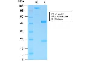 SDS-PAGE Analysis Purified MUC6 Rabbit Recombinant Monoclonal Antibody (MUC6/1553R). (Recombinant MUC6 抗体)