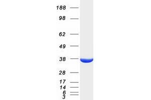 AKR1A1 Protein (Transcript Variant 1) (Myc-DYKDDDDK Tag)