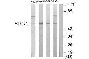 Western blot analysis of extracts from HeLa cells, HepG2 cells, COLO205 cells and 293 cells, using PFKFB1/4 antibody. (PFKFB1/4 抗体  (Internal Region))