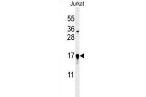 Western Blotting (WB) image for anti-Glutaredoxin 5 (GLRX5) antibody (ABIN3002211) (GLRX5 抗体)