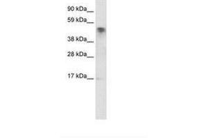 Image no. 1 for anti-Jumonji Domain Containing 5 (JMJD5) (C-Term) antibody (ABIN6735928) (JMJD5 抗体  (C-Term))