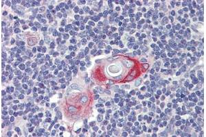 Thymus, Human: Formalin-Fixed, Paraffin-Embedded (FFPE) (CPXCR1 抗体  (AA 396-445))