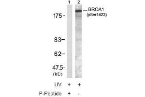 Image no. 2 for anti-Breast Cancer 1 (BRCA1) (pSer1423) antibody (ABIN196994) (BRCA1 抗体  (pSer1423))
