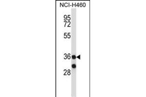 RCH11 Antibody (C-term) (ABIN657732 and ABIN2846717) western blot analysis in NCI- cell line lysates (35 μg/lane). (MARCH11 抗体  (C-Term))
