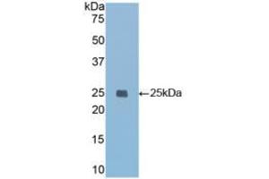 Western blot analysis of recombinant Mouse IGFBP7. (IGFBP7 抗体  (AA 88-281))