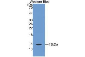 Western blot analysis of recombinant Human MTNR1A. (Melatonin Receptor 1A 抗体  (AA 296-350))