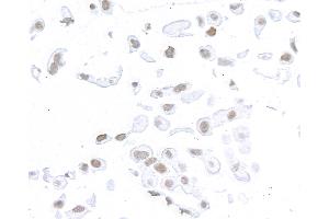 Immunocytochemistry (ICC) image for anti-Structural Maintenance of Chromosomes 1A (SMC1A) (C-Term) antibody (ABIN7455193)