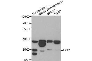 Western blot analysis of extracts of various cell lines, using UCP1 antibody.