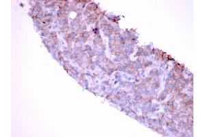 Formalin-fixed, paraffin-embedded human Bladder stained with EGFR Mouse Monoclonal Antibody (GFR/1667). (EGFR 抗体)