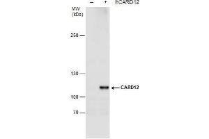 WB Image CARD12 antibody detects CARD12 protein by western blot analysis. (NLRC4 抗体  (N-Term))