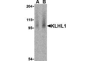 Western Blotting (WB) image for anti-Kelch-Like 1 (KLHL1) (N-Term) antibody (ABIN1031428) (KLHL1 抗体  (N-Term))