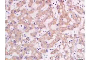 Immunohistochemistry (Paraffin-embedded Sections) (IHC (p)) image for anti-Adaptor-Related Protein Complex 1, mu 2 Subunit (AP1m2) (AA 1-100) antibody (ABIN1713682)