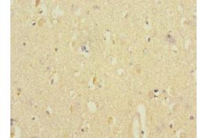 Immunohistochemistry (IHC) image for anti-Ankyrin Repeat and Sterile alpha Motif Domain Containing 1B (ANKS1B) (AA 999-1248) antibody (ABIN7144208)