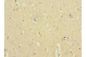 Immunohistochemistry of paraffin-embedded human brain tissue using ABIN7144208 at dilution of 1:100 (ANKS1B 抗体  (AA 999-1248))